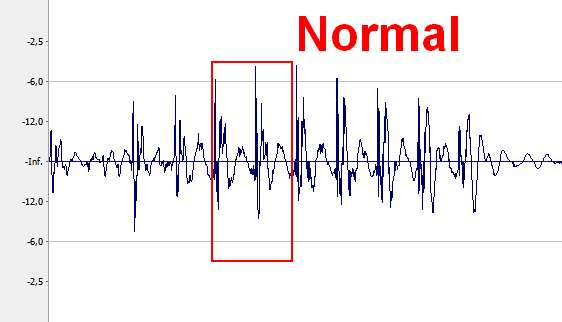 Normal volume curve